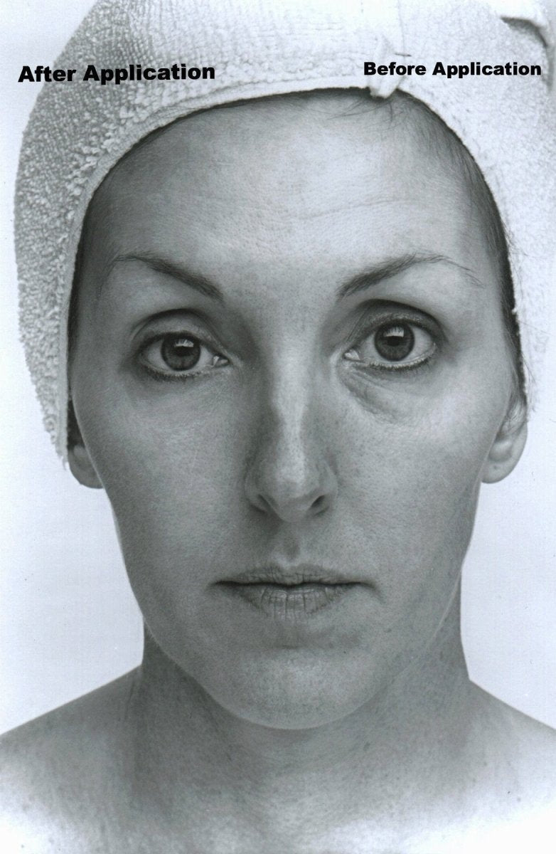 Collagen Lifting Facial with Rapid Wrinkle Erase Cream - Nordavory