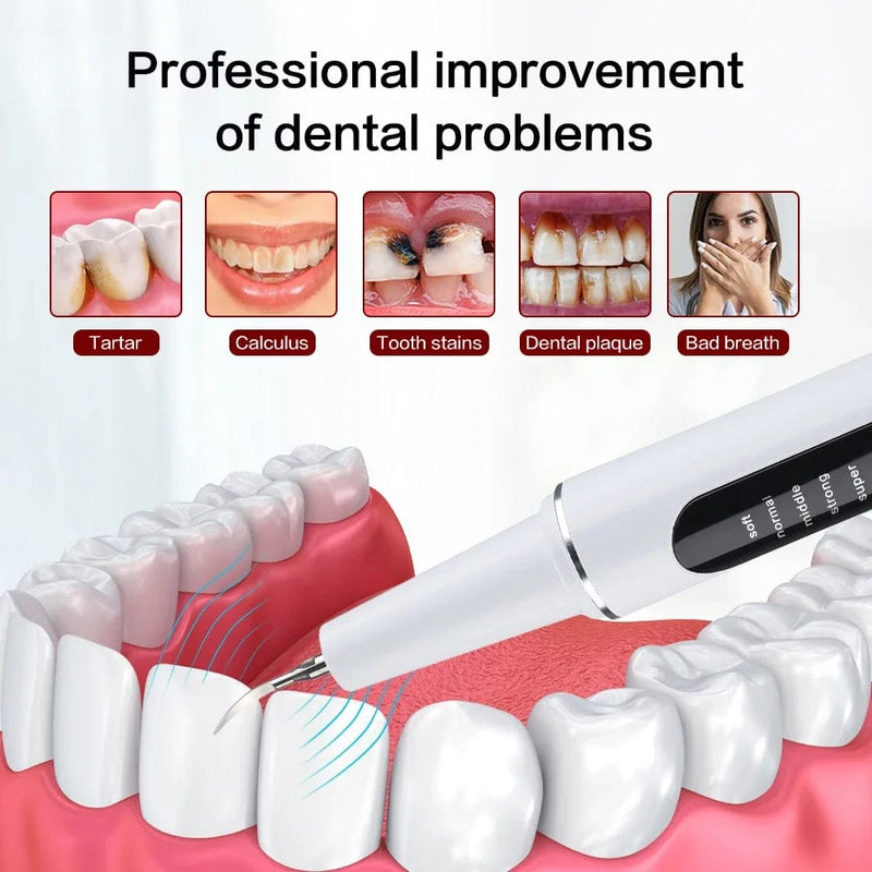 Dental Scaler Ultrasound Electric Tooth Cleaning Oral Care Plaque - Nordavory