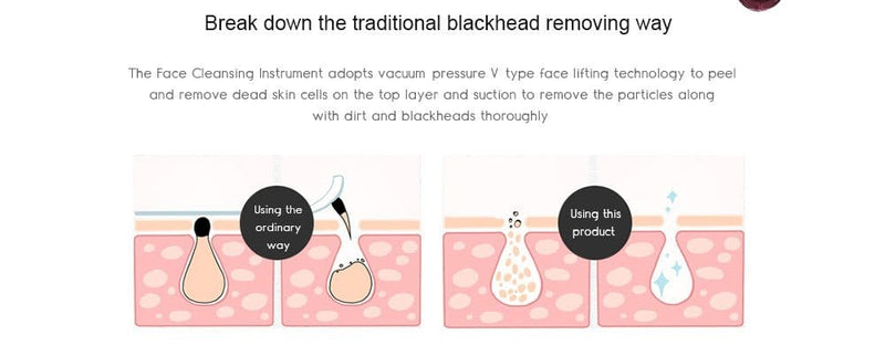 Electric Acne Blackhead Remover Skin Vacuum Bath & Beauty nordavory
