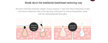 Electric Acne Blackhead Remover Skin Vacuum - Nordavory
