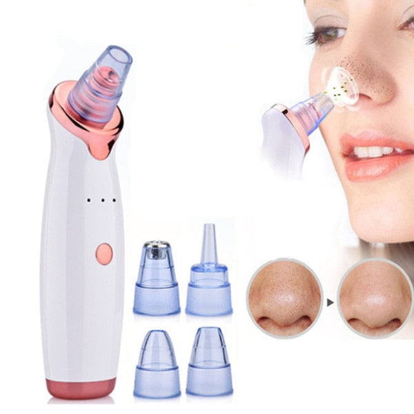 Facial Blackhead Remover Electric Vacuum Machine - Nordavory