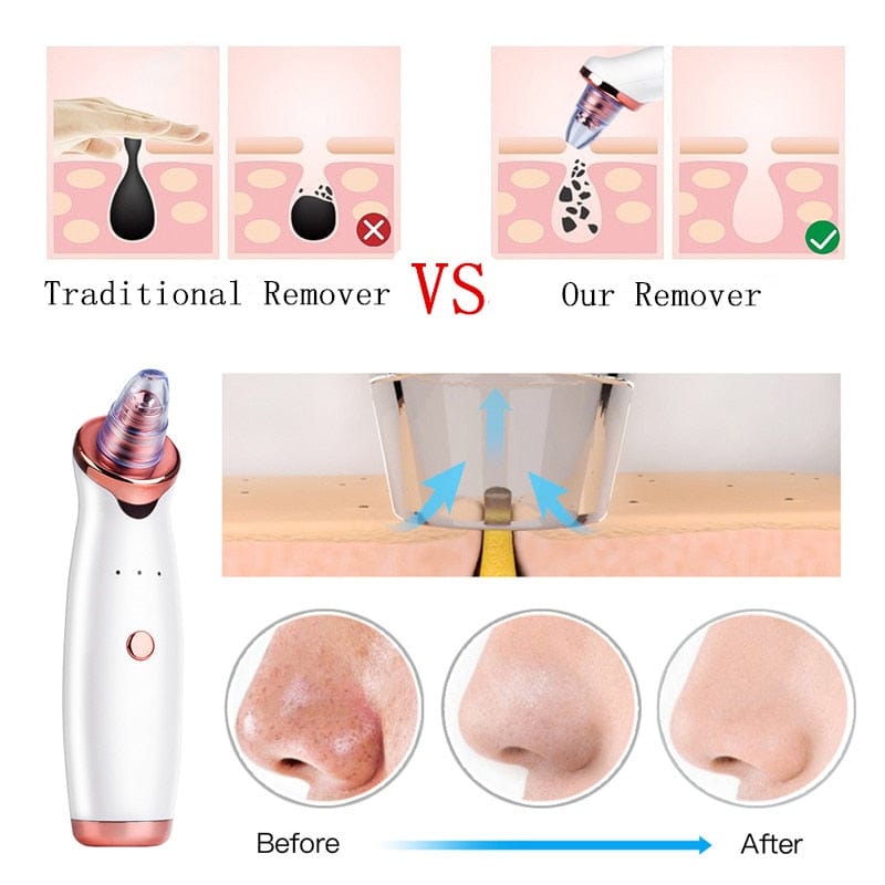 Facial Blackhead Remover Electric Vacuum Machine - Nordavory