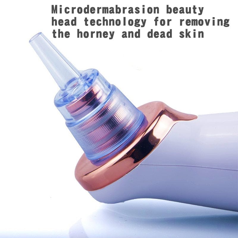 Facial Blackhead Remover Electric Vacuum Machine - Nordavory