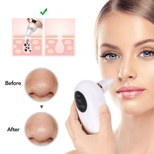 Portable  Face Deep Pore Cleaner Vacuum Blackhead Remover Skincare nordavory